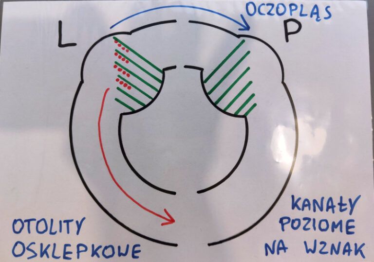 Zawroty głowy — Schematy oczopląsów