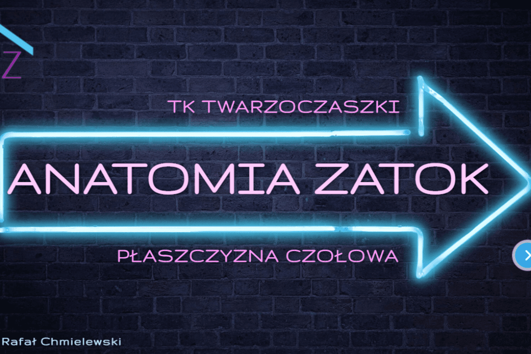 anatomia zatok w TK - płaszczyzna czołowa