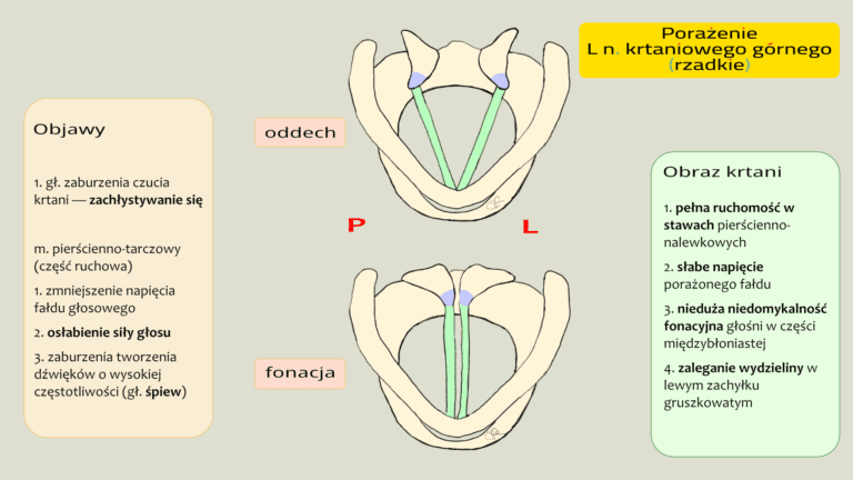 Porażenia krtani – objawy, obrazy krtani w endoskopii i schematy na ścianę – 24-06-2025, Rafał Chmielewski